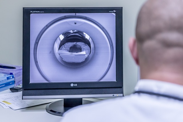 What is TBI? MRI scan of brain injury taking place.