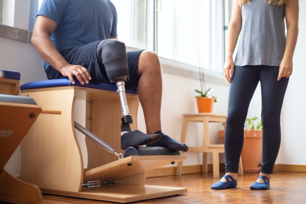 amputation claim young man with prosthetic leg undergoing physiotherapy